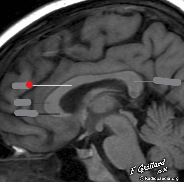 <p>Identify the structure pinned</p>