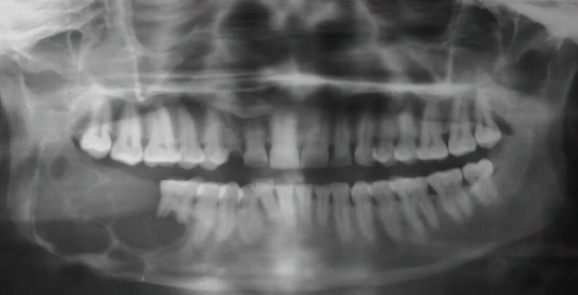 <p>what is the next step. to establish a diagnosis? </p>