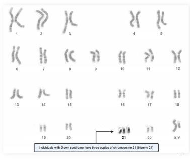 <ul><li><p>Observing chromosomes under a microscope to identify potential chromosomal abnormalities</p></li></ul><p></p><p>Ex: Trisomy 21 / Down syndrome</p><p></p><ul><li><p>Observation occurs during <strong><em>metaphase</em></strong></p></li></ul><p></p>