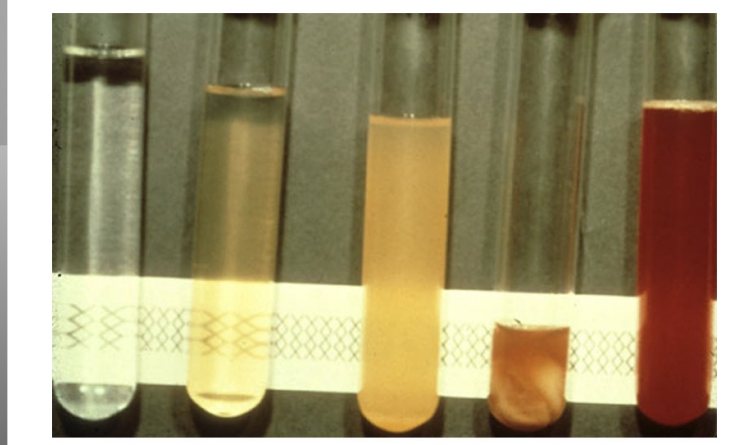 <p>joint fluid appearance from left to right</p>