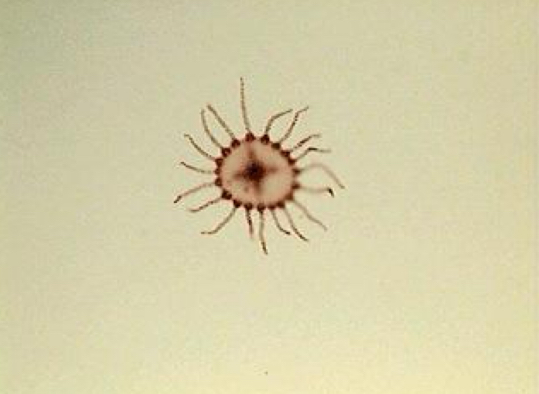 <p>phylum: cnidaria</p>
