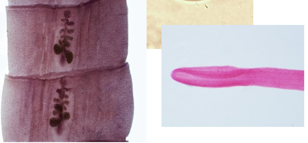 <p>-Scolex is almond-shaoed wuth 2 sucking grooves</p><p>-Proglottids wider than long</p>