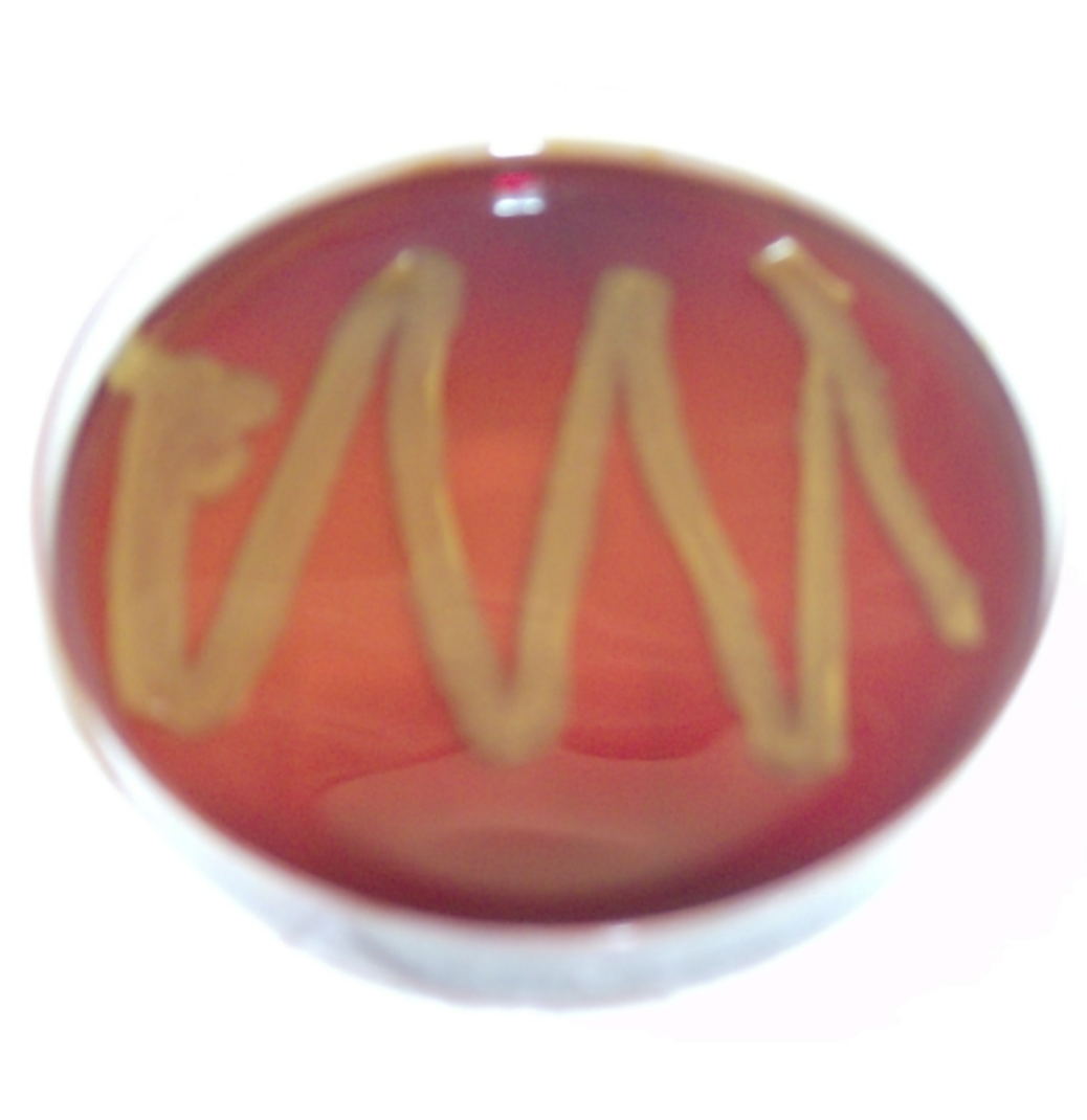 <p>what is the test and result?</p>