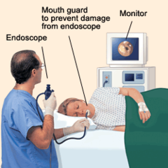 <p>scope entered through esophagus to duodenum to view stomach</p>