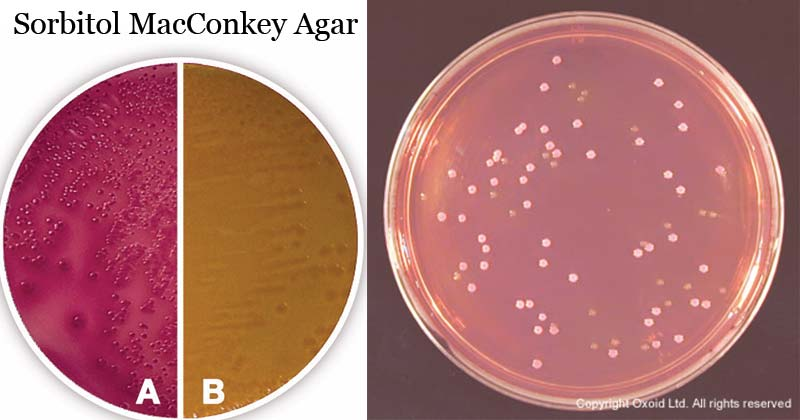 <p>A specialized MAC agar</p><ul><li><p>Selects for GNRs</p></li><li><p>Differentiates sorbitol fermentation (MAC: lactose fermentation) </p></li></ul><p></p><p>Interpretation</p><ul><li><p>Fermenter: pink</p></li><li><p>Nonfermenter: clear </p></li></ul><p></p>