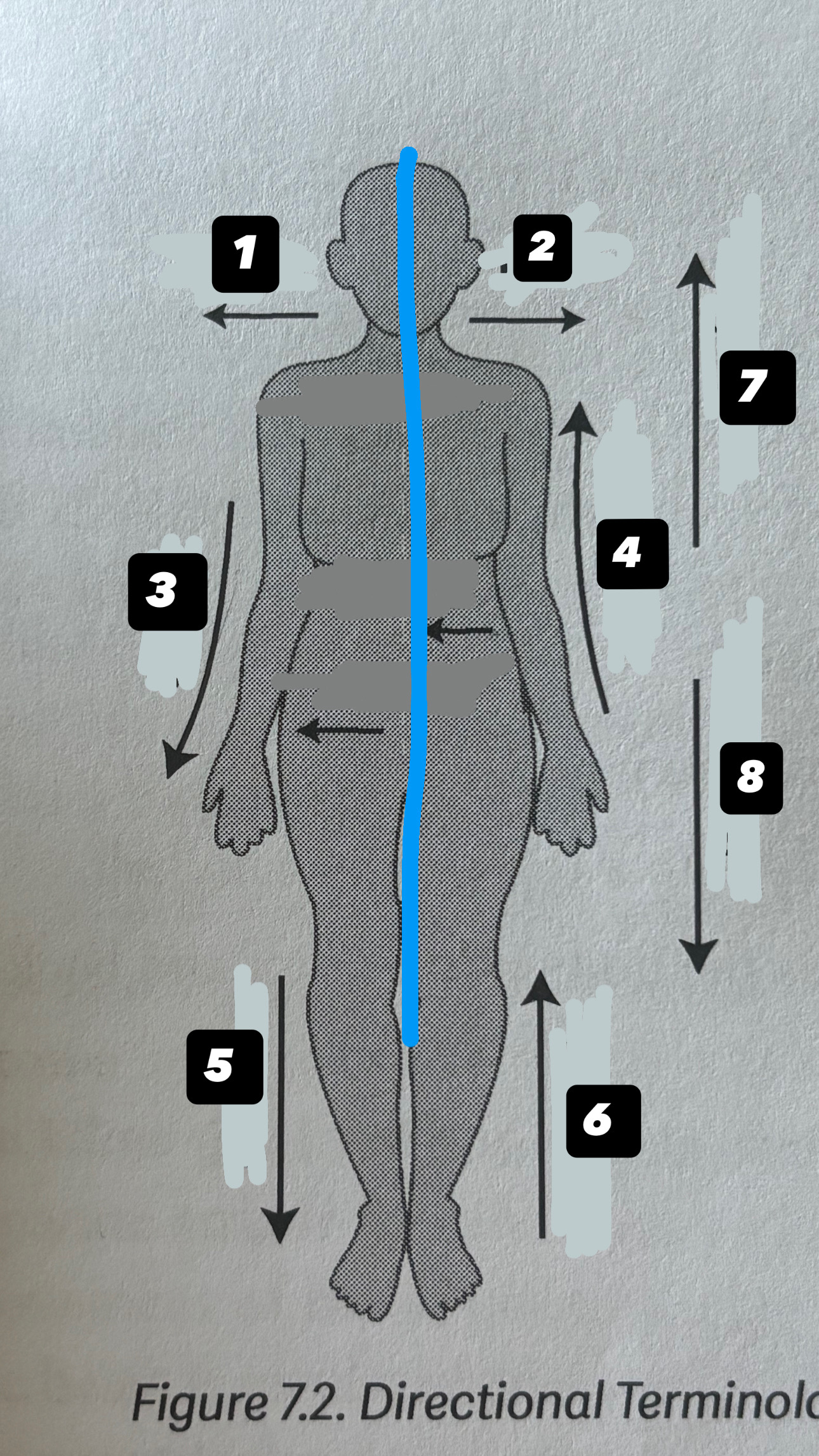 <p>what is the blue line going down the body?</p>