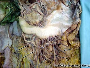 <p>what arteries are being indicated to in the image?</p>