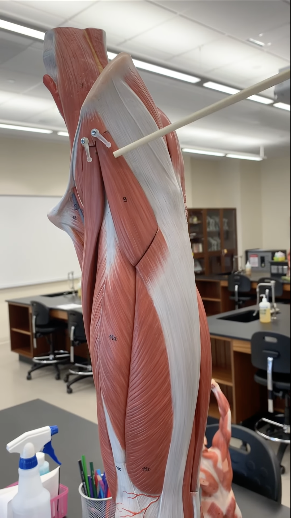 <p>Tensor Fascia Lata</p>