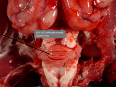 <p>Morph. Dg and Cause</p>