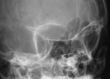 <p><span style="background-color: transparent;">&nbsp;Orbits - Rhese</span></p>