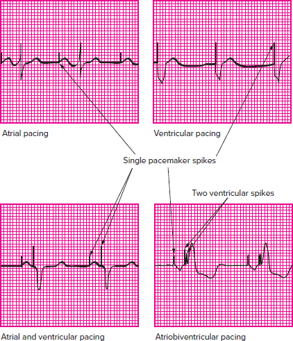 <p>Which rhythm is this?</p>