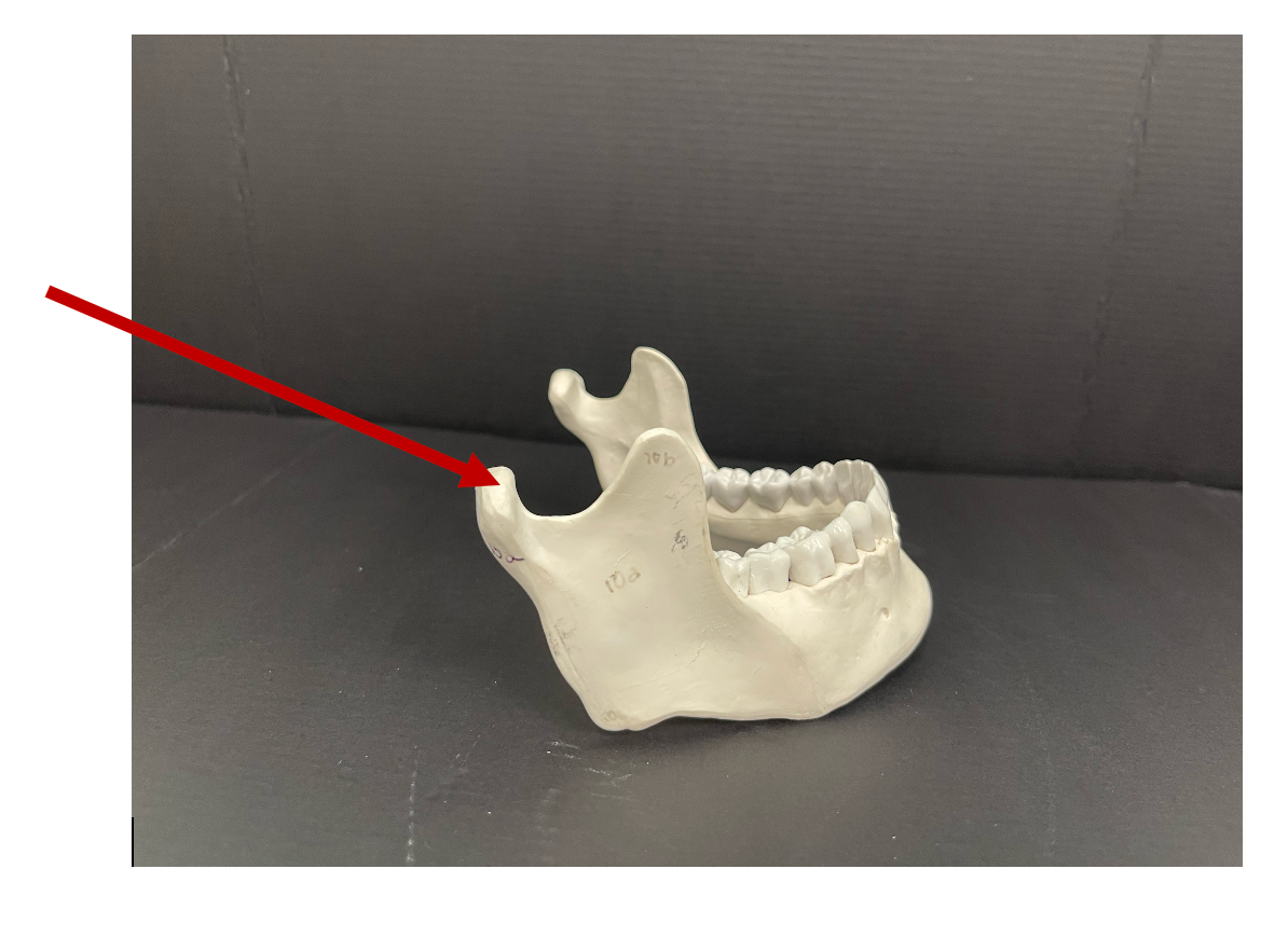 <p>Identify the bony landmark of the mandible that the arrow is pointing to.</p>