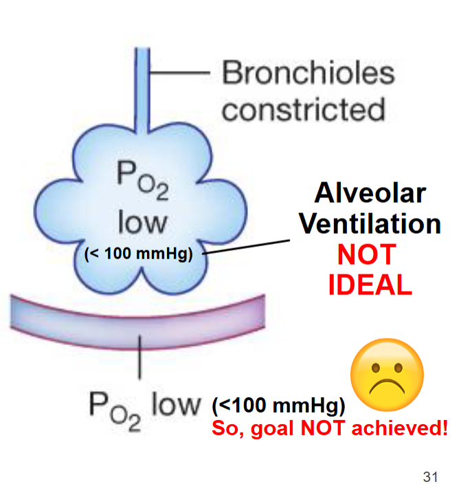 <p>Obstructive lung diseases</p>