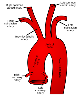 <p>Carry blood away from the heart</p><ul><li><p>To lungs: pulmonary trunk, right &amp; left pulmonary artery</p><ul><li><p>Comes from right ventricle</p></li></ul></li><li><p>To body:</p><ul><li><p>Aorta (from left ventricle)</p></li><li><p>Ascending</p></li><li><p>Arch</p></li><li><p>3 Major Branches</p><ul><li><p>Brachiocephalic</p><ul><li><p>Right common carotid (superior)</p></li><li><p>Right Subclavian (lateral)</p></li></ul></li><li><p>Left common carotid</p></li><li><p>Left subclavian</p></li></ul></li><li><p>Descending: thoracic and abdominal cavity</p></li></ul></li></ul><p></p>