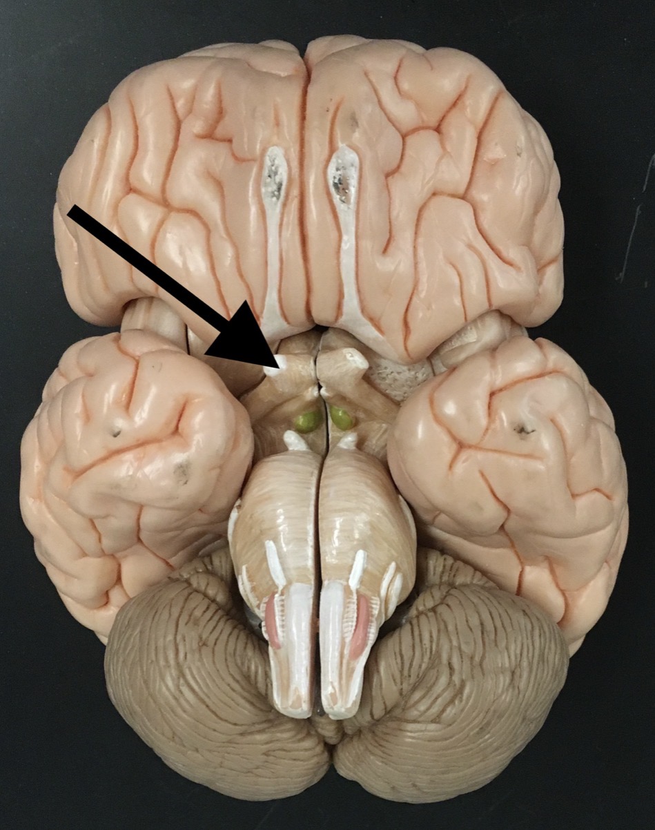 <p>What is the arrow pointing to?</p>