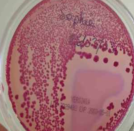 <p>Selectief en electief → isolatie van Yersinia enterocolitica uit klinische en voedselmonsters</p><p></p><p>Selectieve stoffen: mix van antibiotica</p><ul><li><p>Remt de groei van de meeste Enterobacteriaceae en Pseudomonas spp.</p></li><li><p>Cefsulodin → antibioticum dat specifiek de groei van gramnegatieve bacteriën remt, irgasan (triclosan) → breedspectrum antimicrobieel middel dat de groei van begeleidende flora remt, novobiocin → antibioticum dat grampositieve en sommige gramnegatieve bacteriën remt</p></li></ul><p></p><p>Selectieve stoffen: deoxycholate = galzout</p><ul><li><p>Remt de groei van grampositieve bacteriën</p></li></ul><p></p><p>Electieve stoffen: mannitol en neutraalrood</p><ul><li><p>Mannitol en neutraalrood: mannitolnegatieve kolonies (die kunnen groeien) kleuren wit/kleurloos, mannitolpositieve kolonies kleuren dieprood (zuurproductie en lagere pH zorgen voor kleurverandering) → Y. enterocolitica vormt kolonies met een dieprood centrum en een transparante rand = bull’s eye</p></li></ul><p></p>