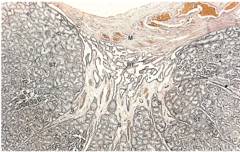 <p>What important network is contained within the mediastinum testis?</p>