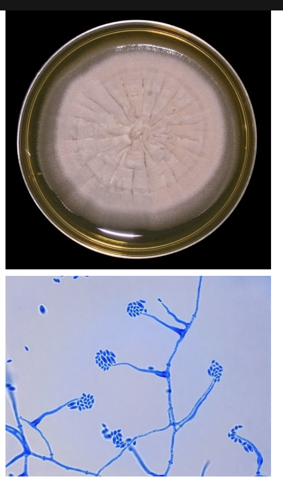 <p>-Grey, white, or pink colonies</p><p>-Long, narrow, unbranched phialides with clusters of microconidia</p>