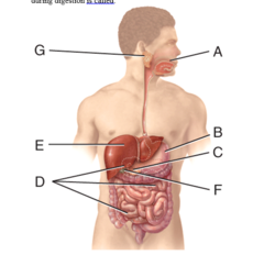 <p>peptic ulcers</p>