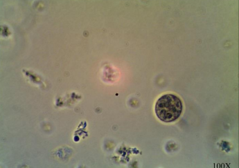 <p>PATHOGENIC PROTISTS: (diarrhea w/ blood)</p>