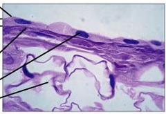 <p>Single layer of flattened cells with disc-shaped central nuclei and sparse cytoplasm; simplest epithelia</p>