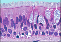 <p>Identify the highlighted structure</p>