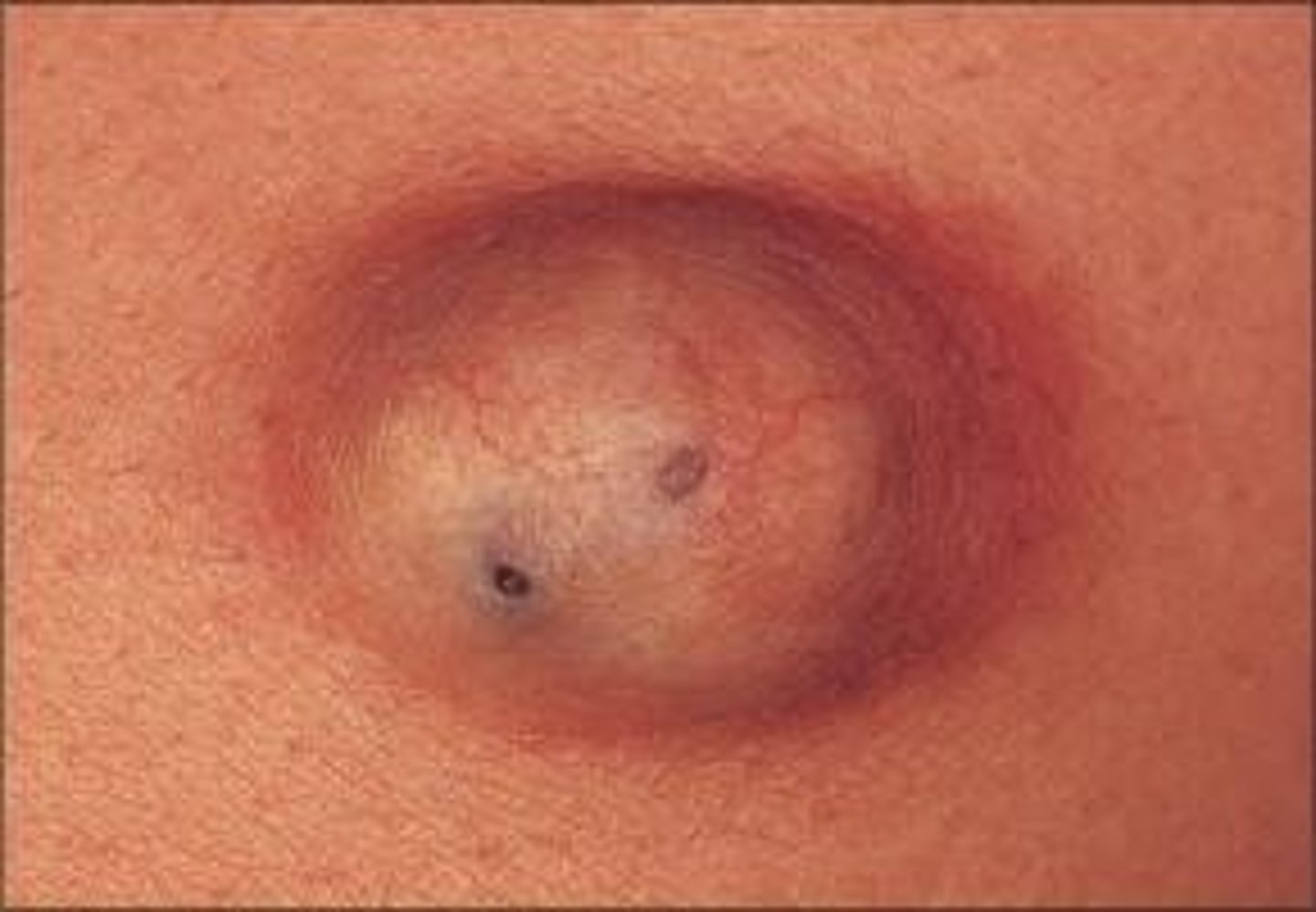 <p>sac containing fluid</p>