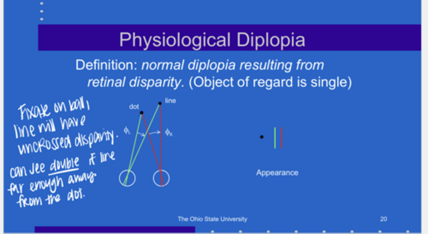 <p>What is the definition of physiological diplopia?</p>