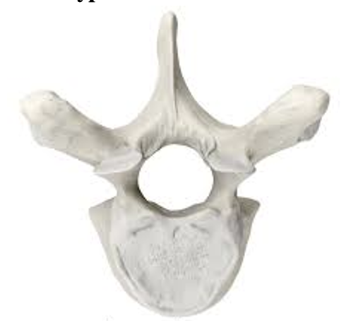 <p><span style="line-height: 18.4px;"><strong>What type of vertebrae is in the following photo?</strong></span></p><p><span style="line-height: 115%;"><strong>a.</strong></span><strong>&nbsp;</strong><span style="line-height: 18.4px;">Cervical</span></p><p class="MsoNormal"><span style="line-height: 115%;"><strong>b.</strong></span><strong>&nbsp;</strong><span style="line-height: 18.4px;">Thoracic</span></p><p class="MsoNormal"><span style="line-height: 18.4px;"><strong>c. </strong>Lumbar</span></p>