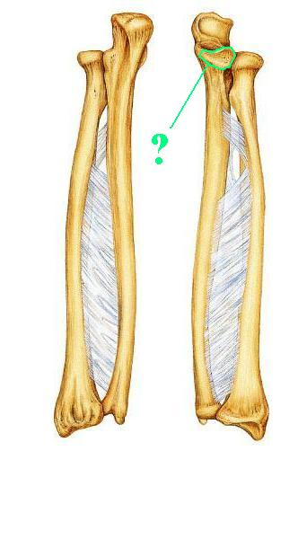 <p>Identify the indicated bone marking (projection)</p>