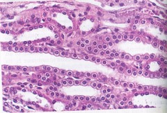 <p>Simple Cuboidal epithelial tissue</p>