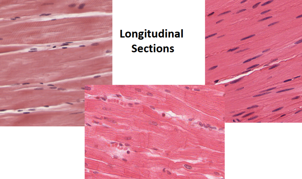 <p>Muscle Longitudinal Sections (identify)</p>