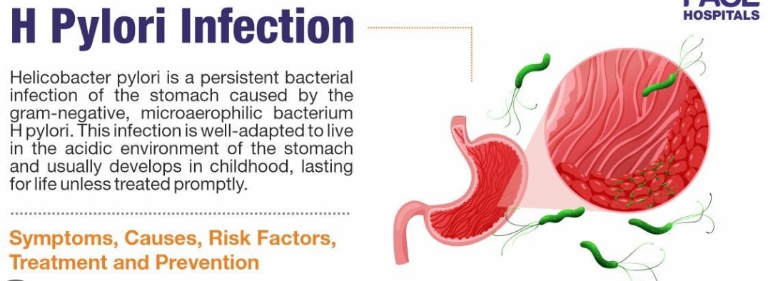 <p>what are the quadruple therapy for H. Pylori? </p>