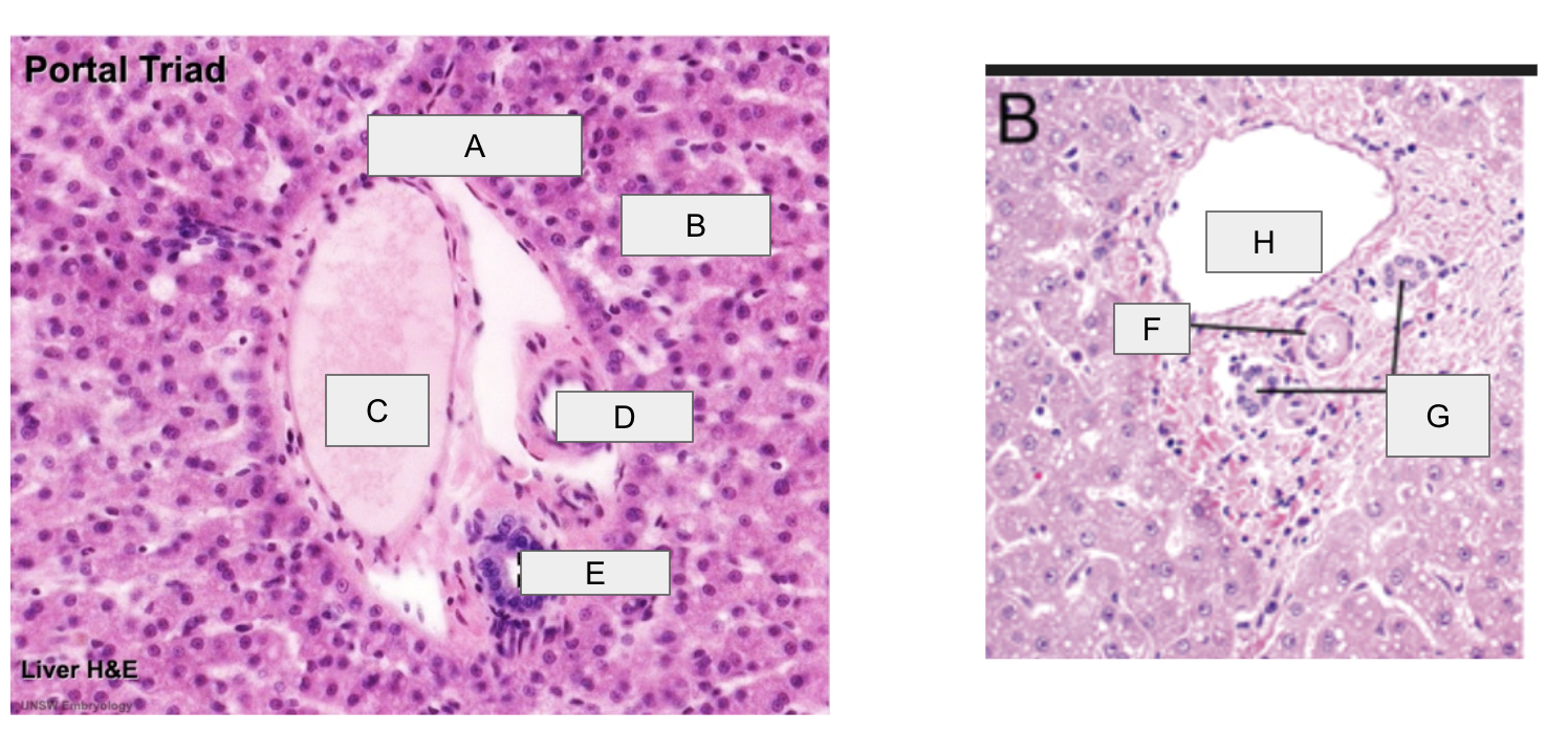 <p>label portal triad </p>
