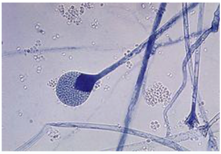 <p>Genus </p>