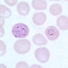 <ul><li><p>least common</p></li><li><p>resembles vivax</p></li><li><p>enlarged RBCs, may have an oval shape with fringed edges</p></li><li><p>mature schizont has <strong>6-12 merozoites</strong></p></li></ul><p></p>