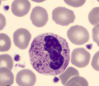 <p>Heavy, dark azurophilic granules</p>