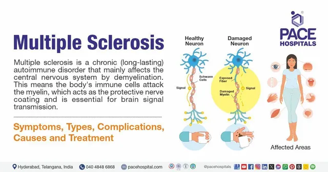 <p>Multiple Sclerosis (MS) is a progressive disease that breaks down the ______ ______ causing nerves to not properly send messages.</p>