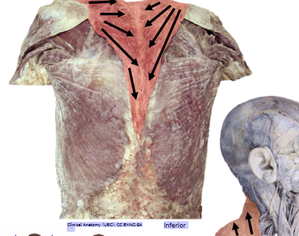 <p>What’s the name of this muscle, and its OIAN<span style="color: transparent;">? Anatomy (UBC): CC BY-NC-SA 4</span></p>