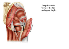 <p>Origin: ischial tuberosity</p><p>Insertion: intertrochanteric crest</p><p>Action: adducts and rotates hip</p>