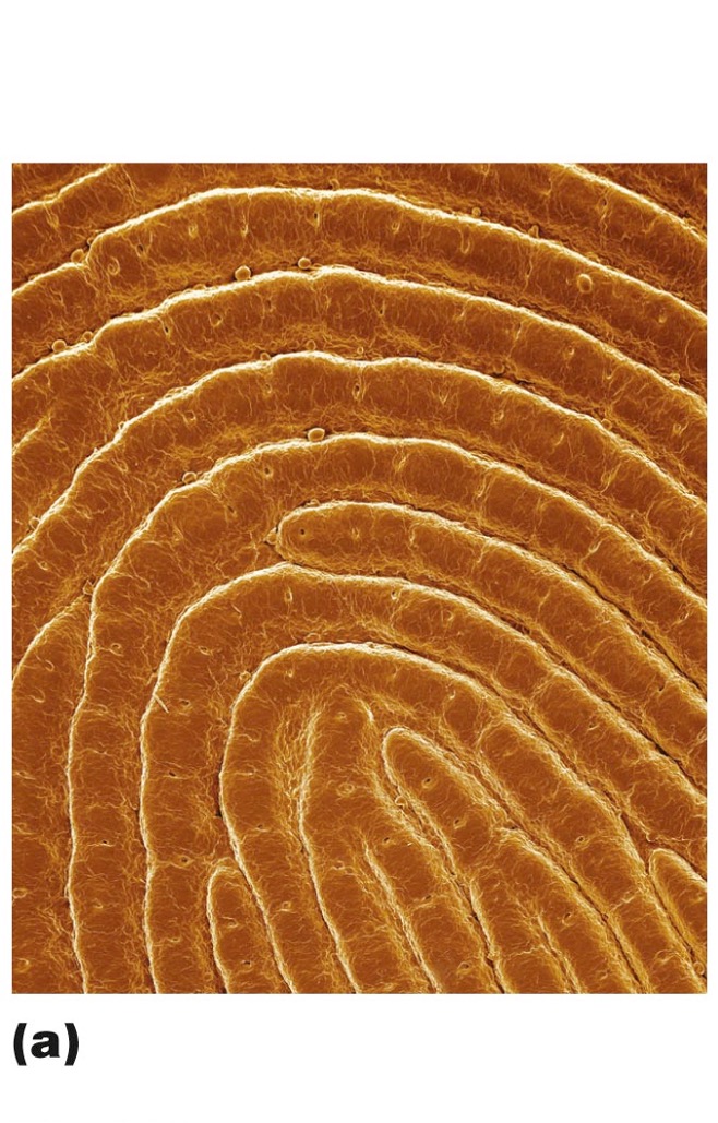 <p>superficial peg-like projections from the papillary layer of the dermis</p><ul><li><p>in thick skin → friction ridges in the epidermis → aka fingerprints!</p></li><li><p>function: enhance gripping ability, contribute to sense of touch</p></li></ul><p></p>