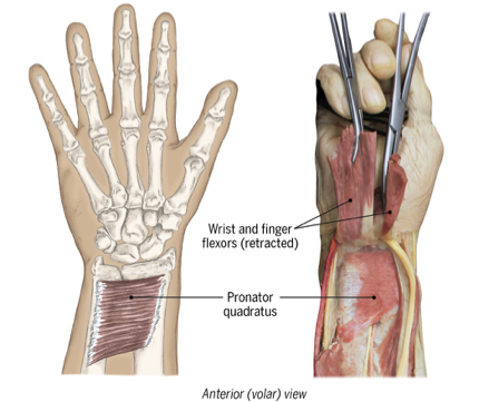 <p>active during all forearm pronation, </p><p>pronates also w elbow flexed</p><p></p><p>ex: <span>Shaving or putting on makeup&nbsp;</span></p>