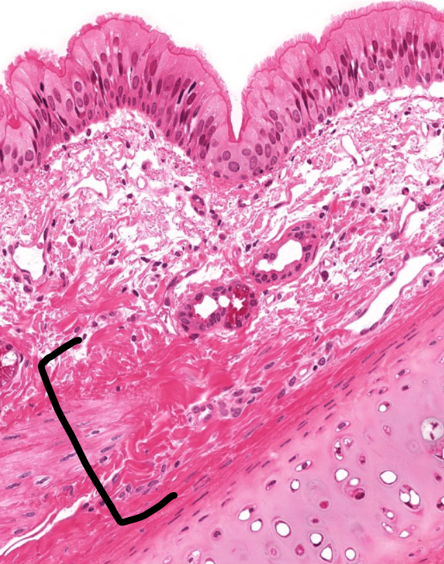 <p>identify the layer </p>