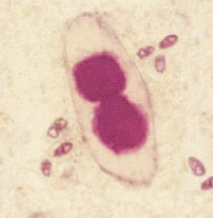 <p>What parasite is this?</p>