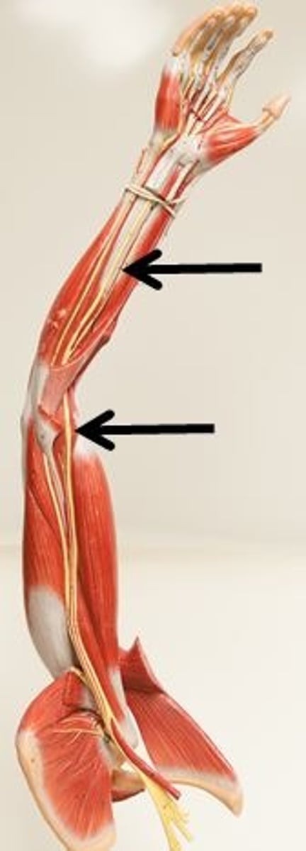 <p>Identify this nerve.</p>