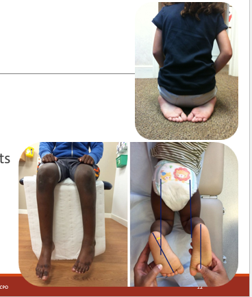 <p>Sitting on the feet </p>