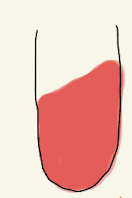 <p>TSI</p>