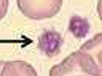 <p>Bloedplaatjes</p><ul><li><p>Bloedstelping (hemostase) → hechting subendotheliaal collageen → factoren komen vrij en doen plaatjes sammenklonteren </p></li><li><p>Fibrogeen slaat neer tot fibrine </p></li></ul><p></p>