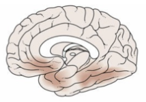<p>Que etapa del Alzheimer representa esta imágen en relacion con la propagación de la enfermedad en el cerebro?</p>