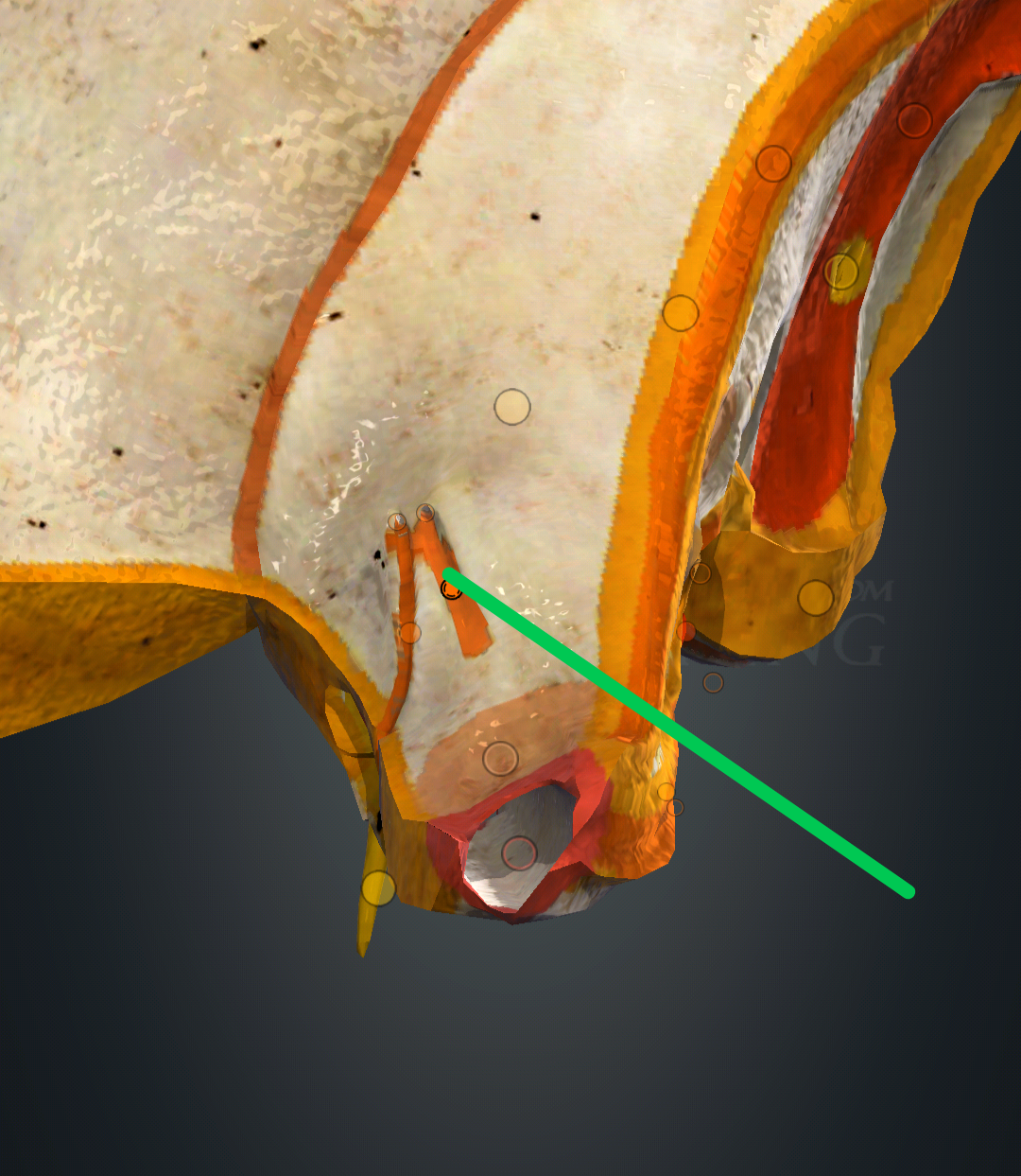 <p>sulcus nervi petrosi majoris</p>